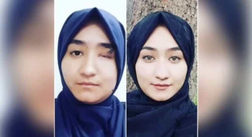 فاطمه امیری، بازمانده کاج؛ نماد پشتکار و الگوی مقاومت و پیروزی فاطمه امیری، بازمانده کاج؛ نماد پشتکار و الگوی مقاومت و پیروزی